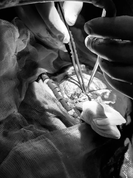 Докторы БСМП Челнов выручили многодетную мама с мощным кровоизлиянием в мозг Докторы БСМП Челнов выручили многодетную мама с мощным кровоизлиянием в мозг