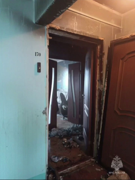 В Челнах женщина получила глубокие ожоги из-за неосторожного курения В Челнах женщина получила глубокие ожоги из-за неосторожного курения